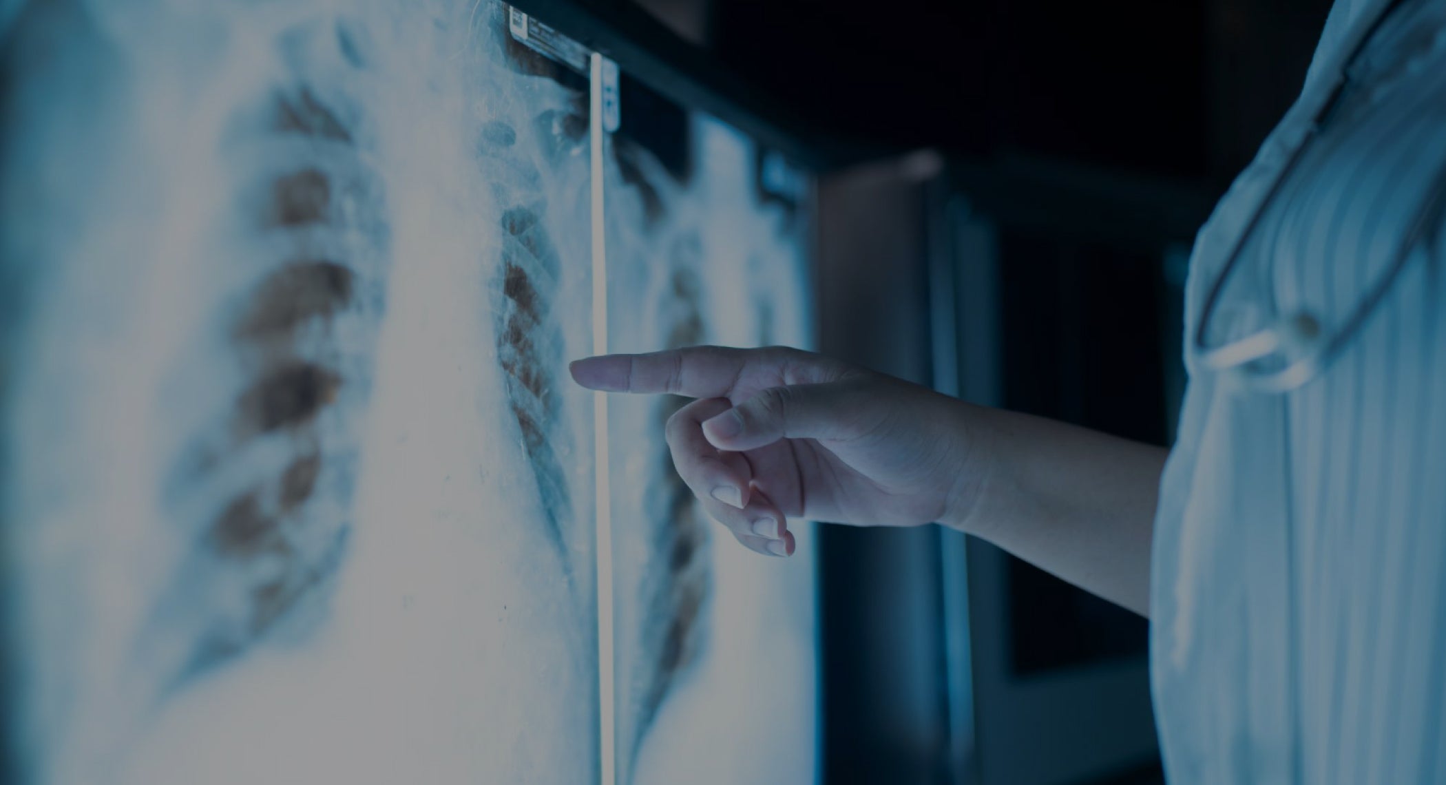 Accelerating Bone Healing