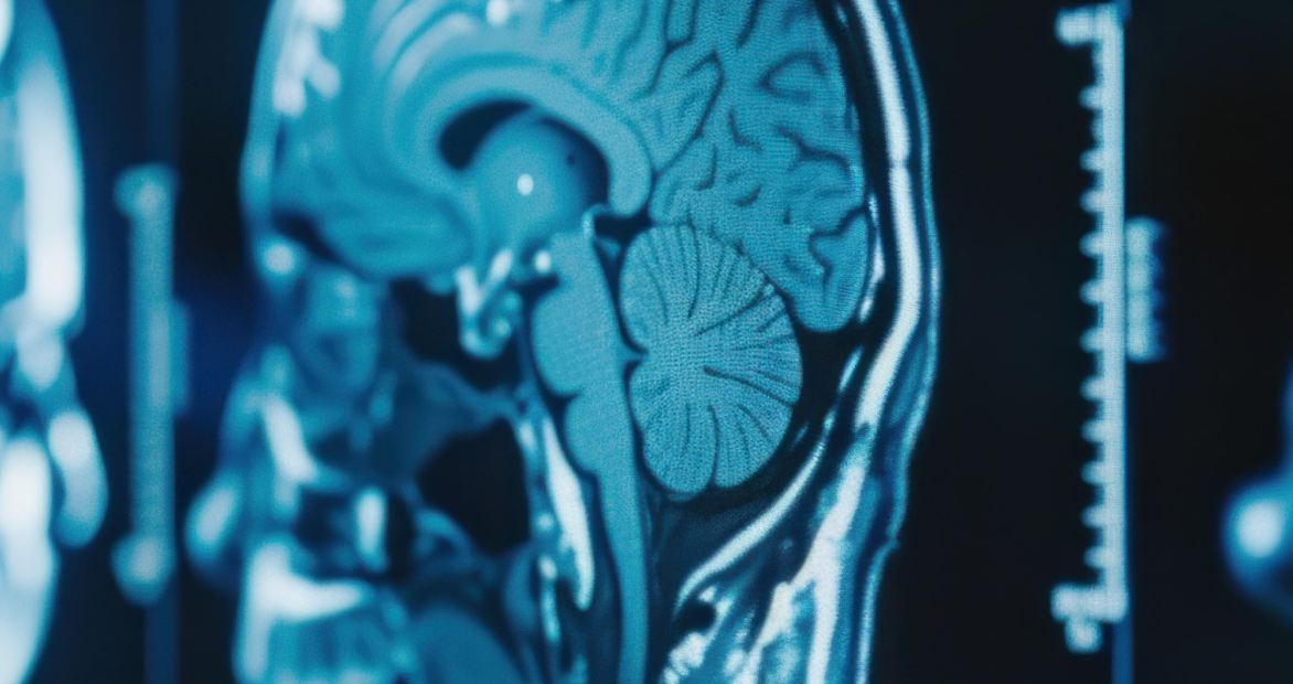 Neuroplasticity & Brain Support — Hyperbaric Oxygen Therapy (HBOT)