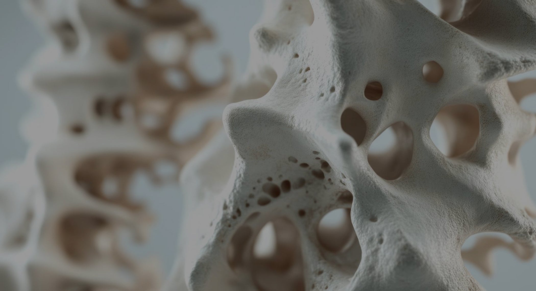 How Hyperbaric Oxygen Therapy Can Help Combat Osteoporosis