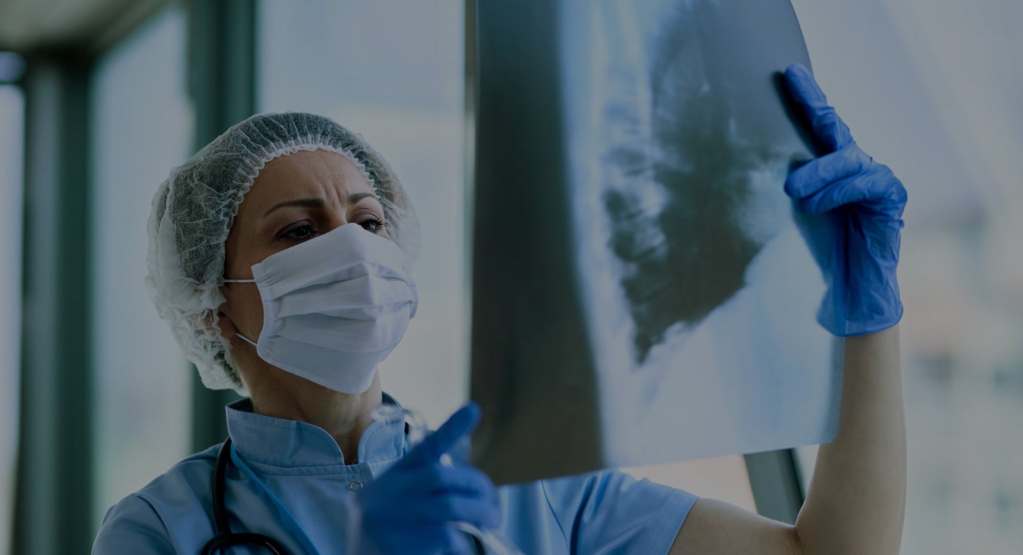 SARS-CoV-2 Pneumonia